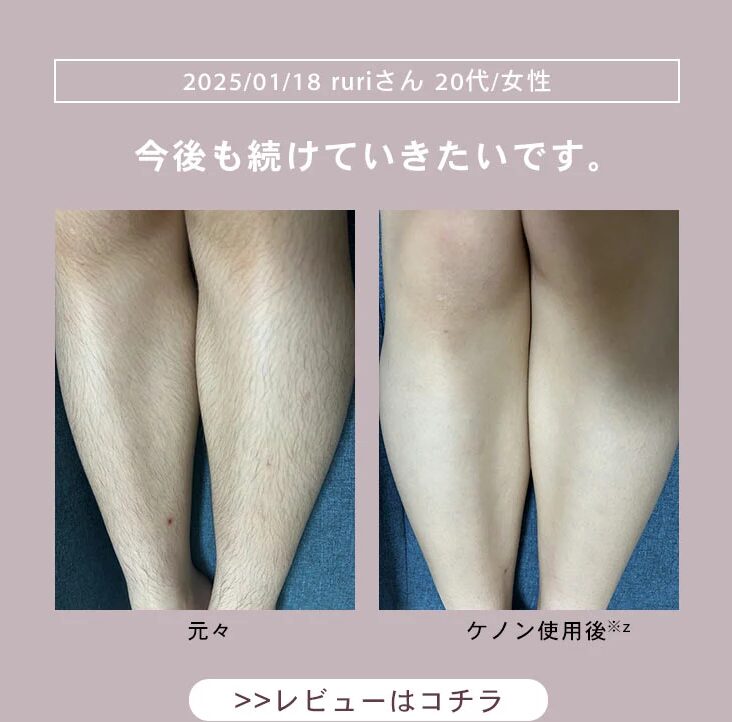 ケノン効果